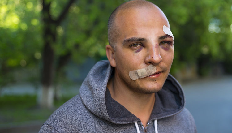 Арендодателей Навального начали избивать